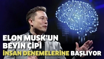 Elon Musk'un beyin çipi insan denemelerine başlıyor