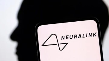Neuralink'in beyin çipi ilk kez bir insana yerleştirildi